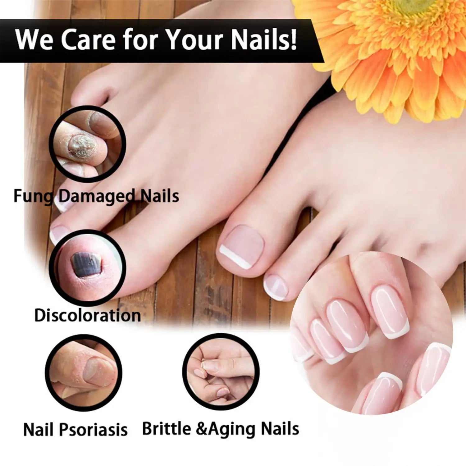 EELHOE Nail Repair Solution Thickening And Brightening Nails Removing Gray Nourishing Care