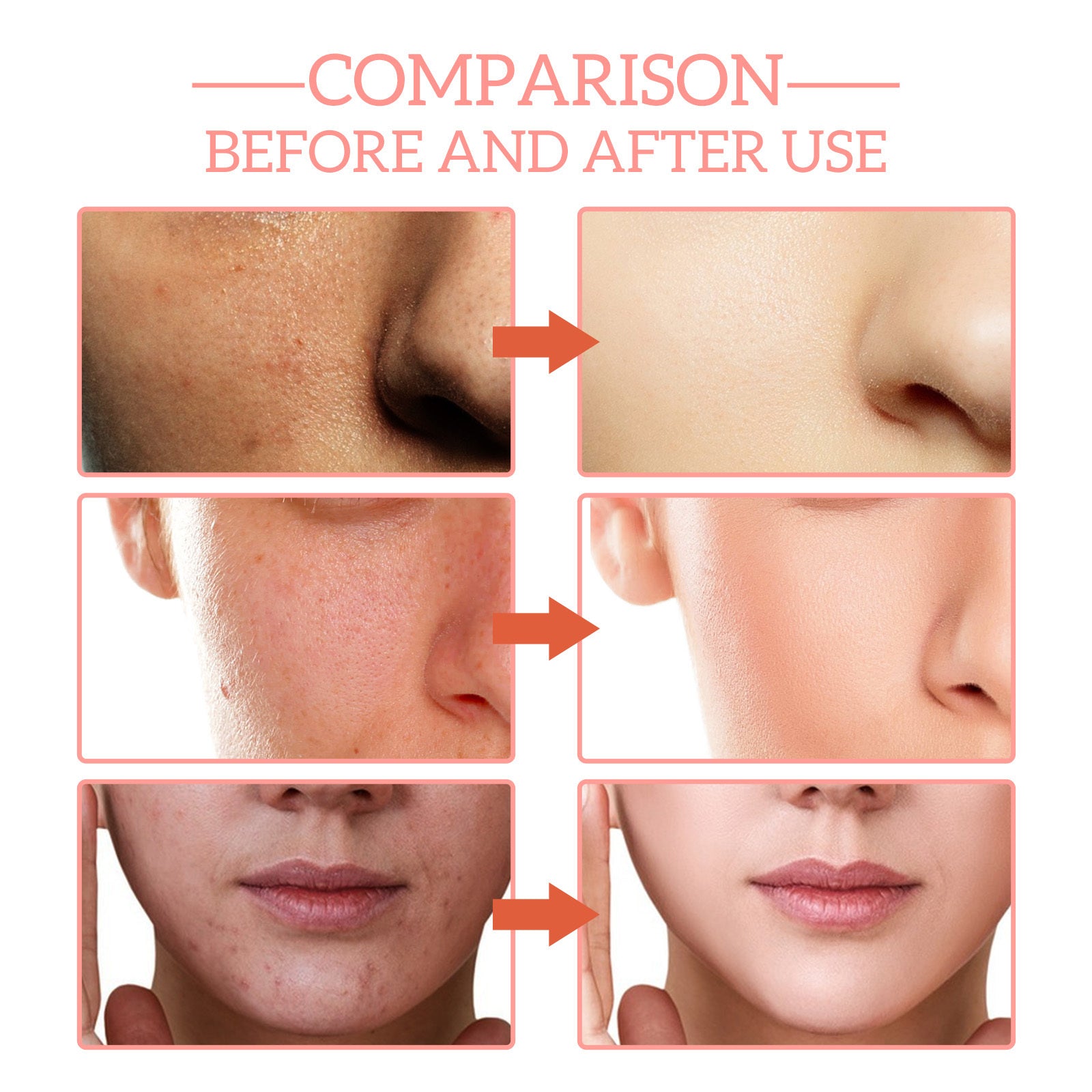 5 In 1 Facial Serum,30 Vitamin C Face Serum,Anti Aging Reduces Wrinkles Hydrating Collagen Serum