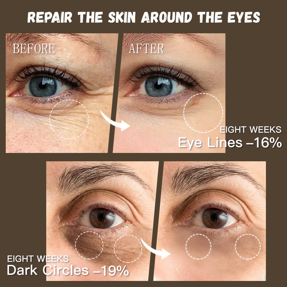 GUANJING Natural Skincare Retinol Eye Cream Vegan Organic Anti Aging Moisturizer wrinkle Skin Whitening 1pc