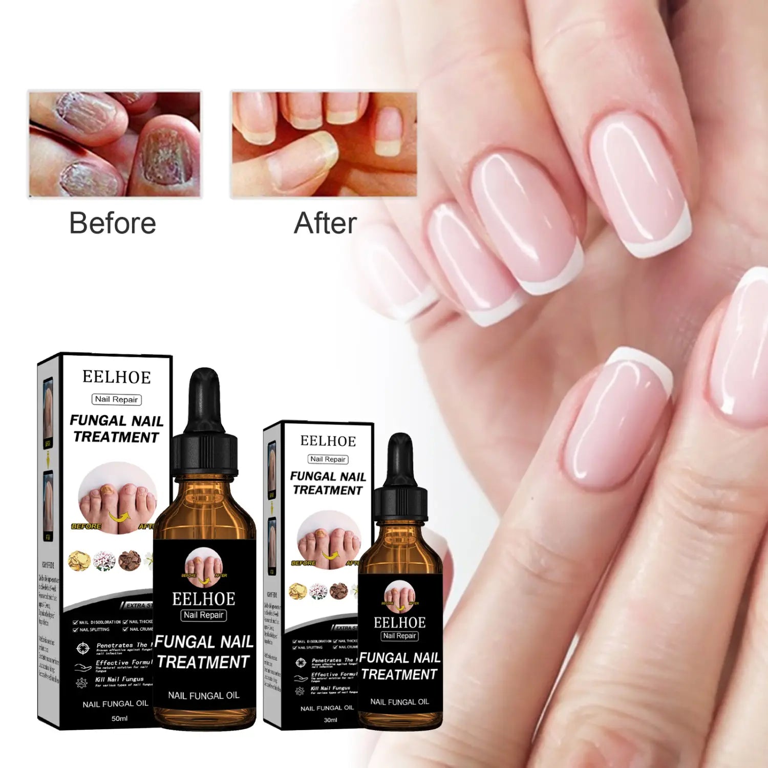 EELHOE Nail Repair Solution Thickening And Brightening Nails Removing Gray Nourishing Care