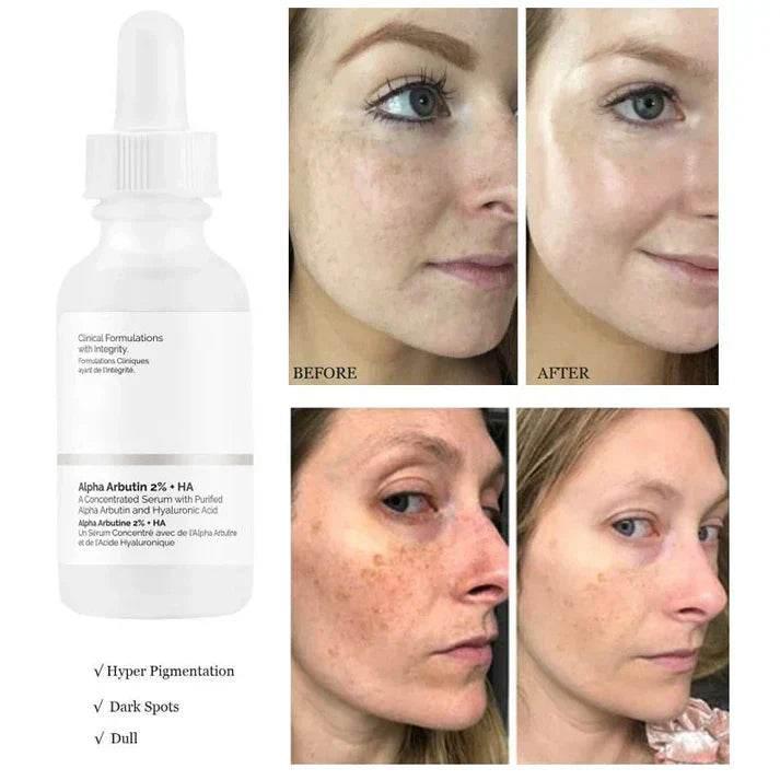 The Ordinary Alpha Arbutin 2% + HA
