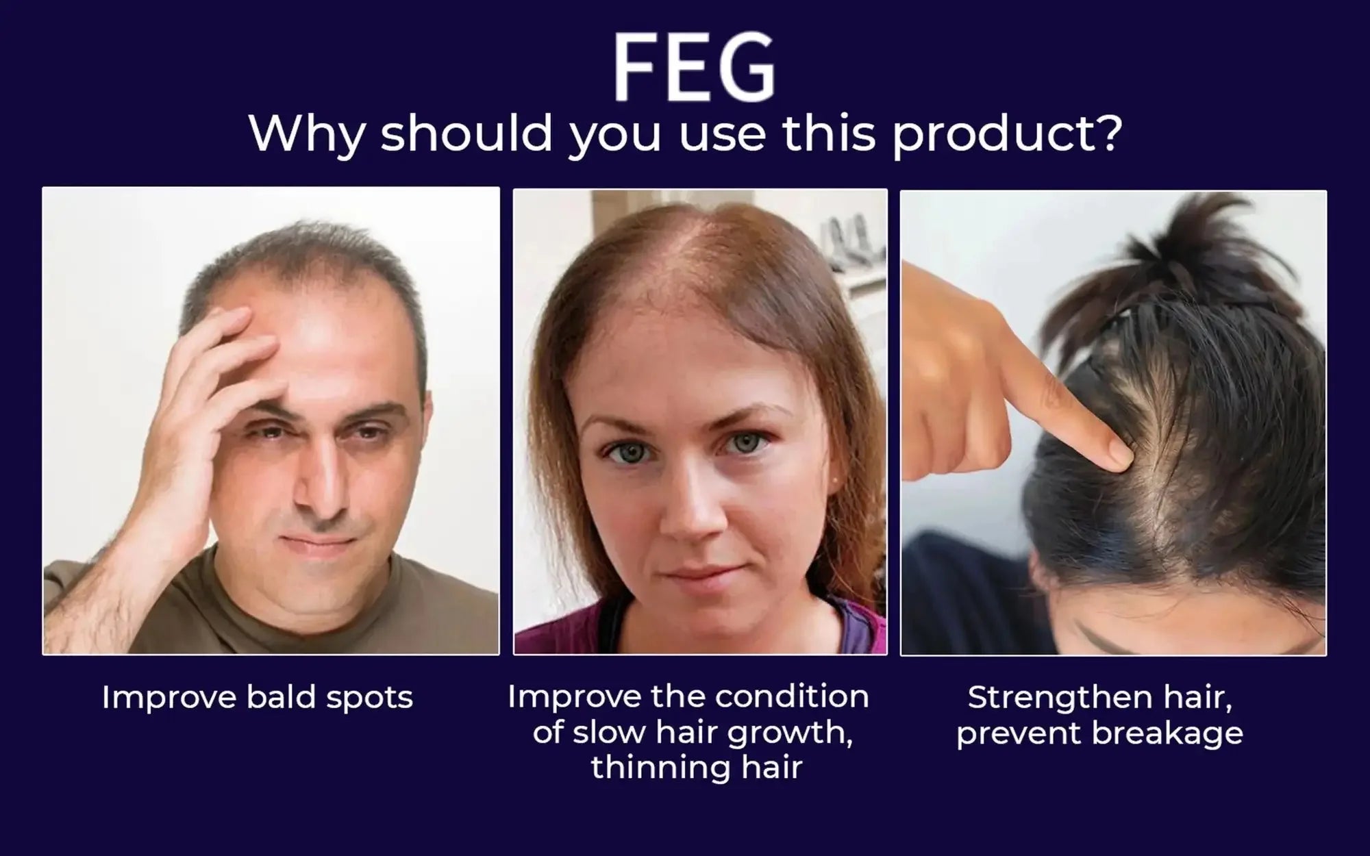 FEG Organic Hair Growth Treatment Oil