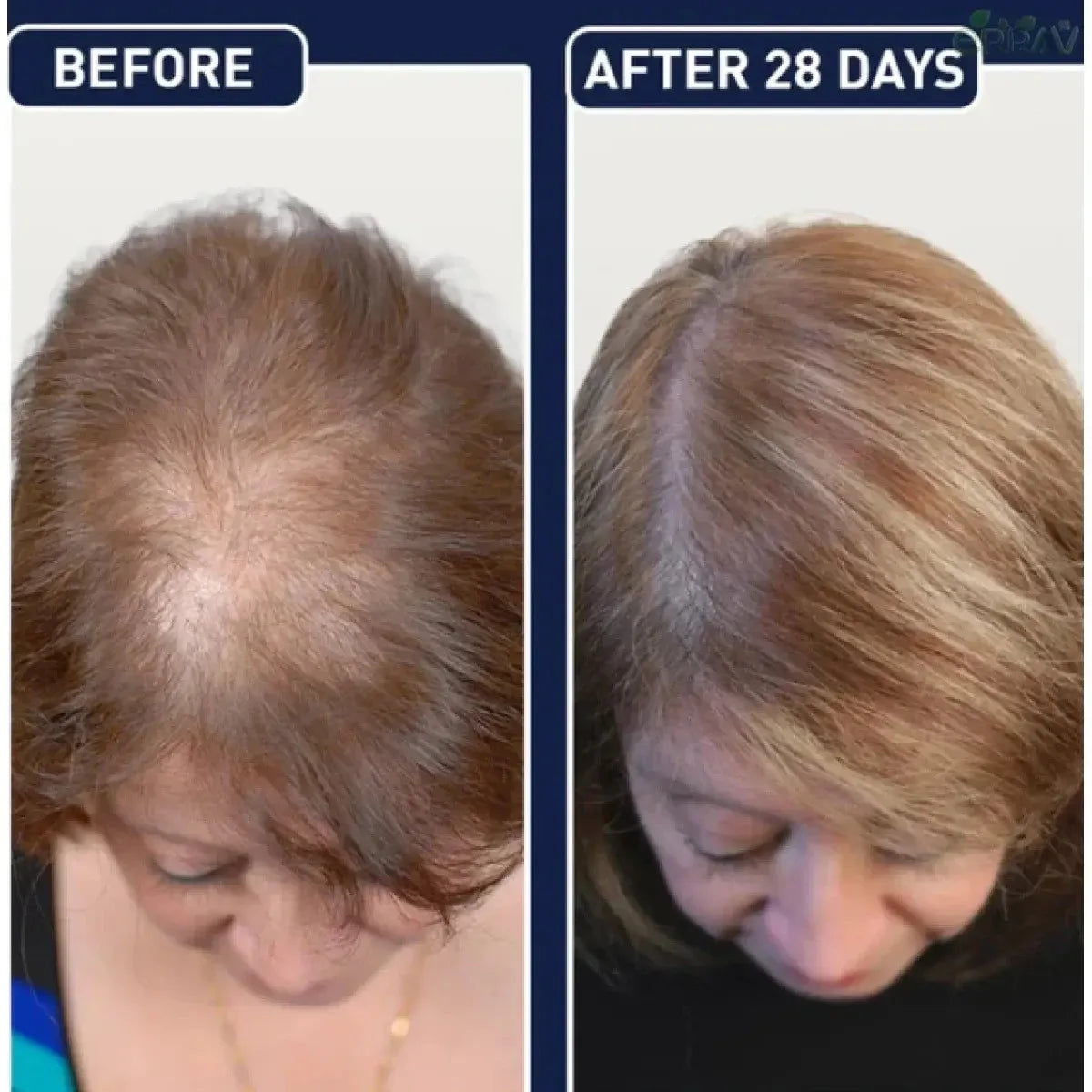 FEG Organic Hair Growth Treatment Oil