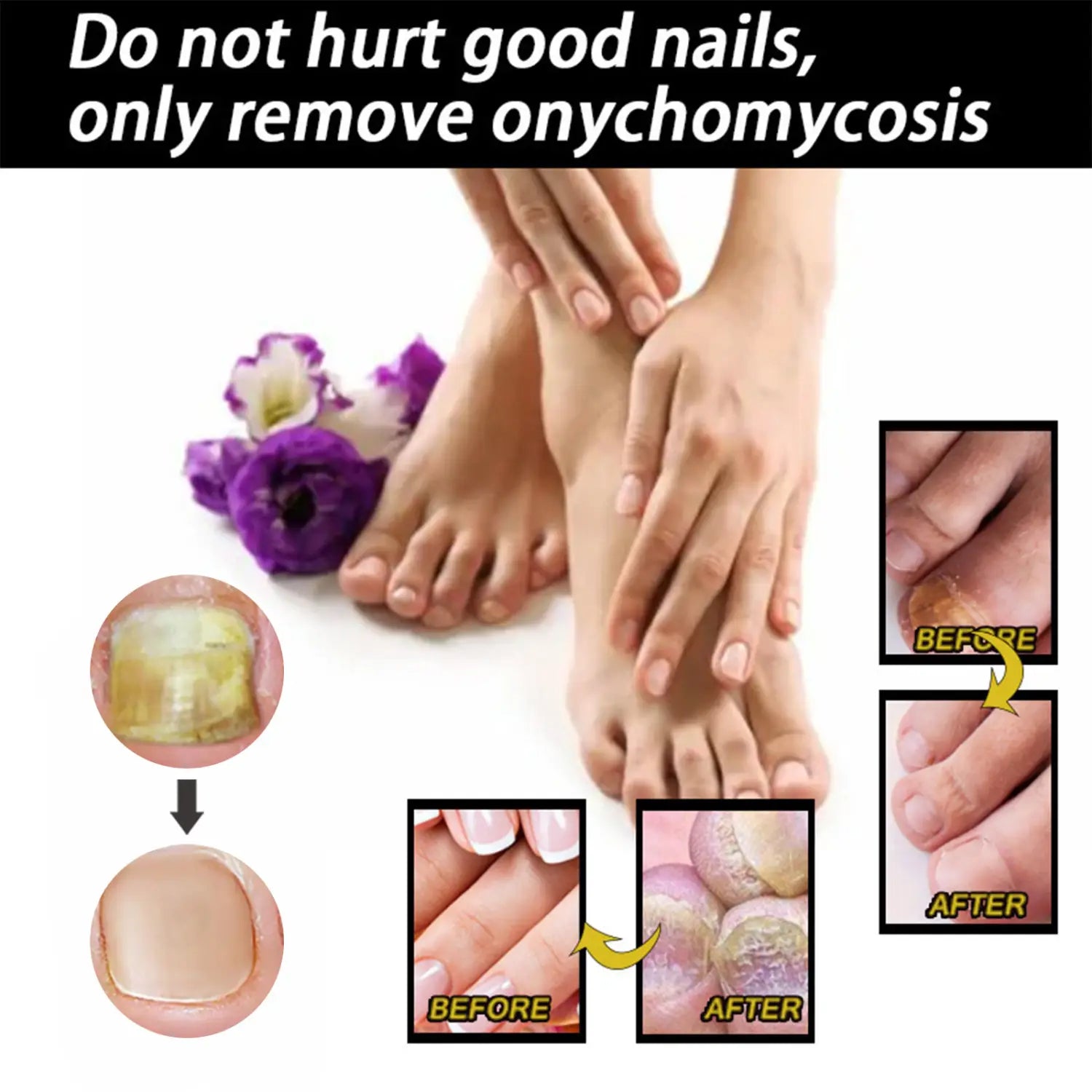 EELHOE Nail Repair Solution Thickening And Brightening Nails Removing Gray Nourishing Care