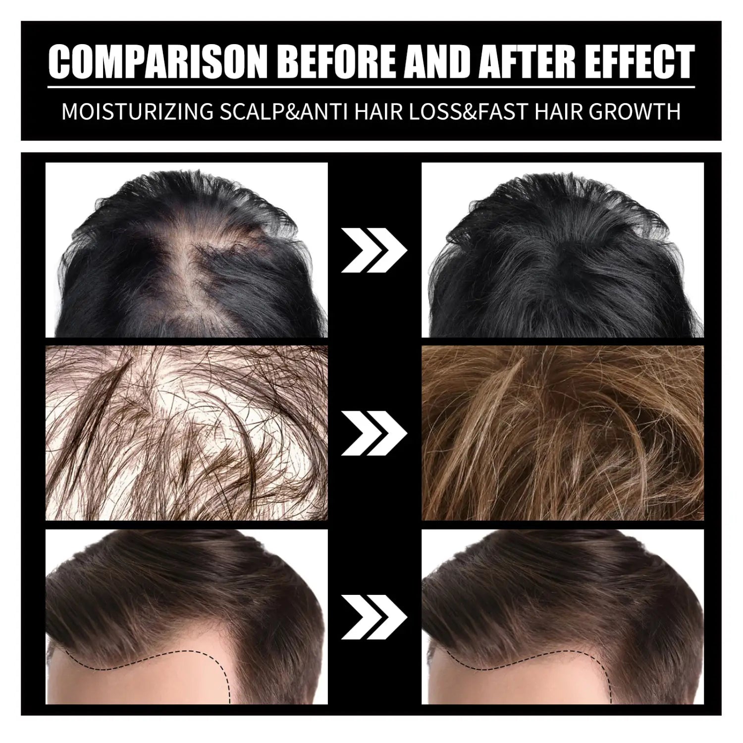 RESEARCH Liquid Biotin & Collagen Hair Growth Drops And Supplement For Men Women Glowing Skin Support Healthy Nail