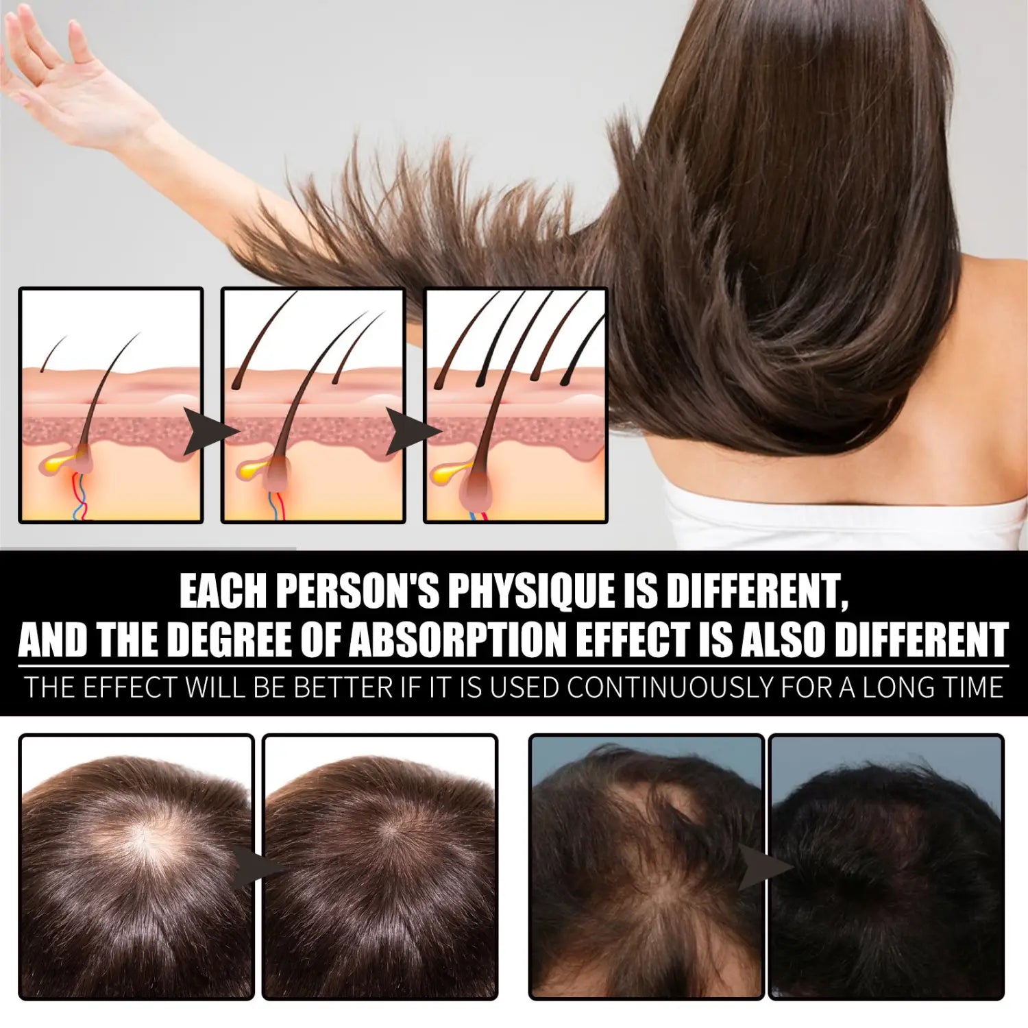 RESEARCH Liquid Biotin & Collagen Hair Growth Drops And Supplement For Men Women Glowing Skin Support Healthy Nail