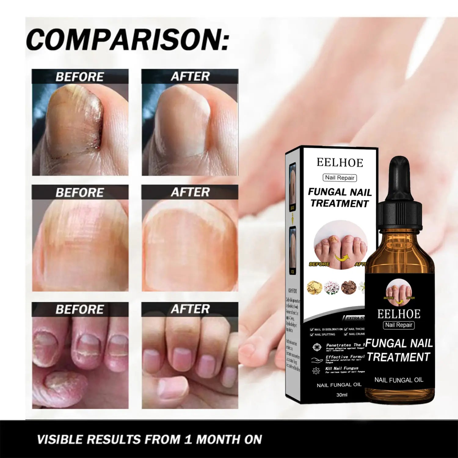 EELHOE Nail Repair Solution Thickening And Brightening Nails Removing Gray Nourishing Care